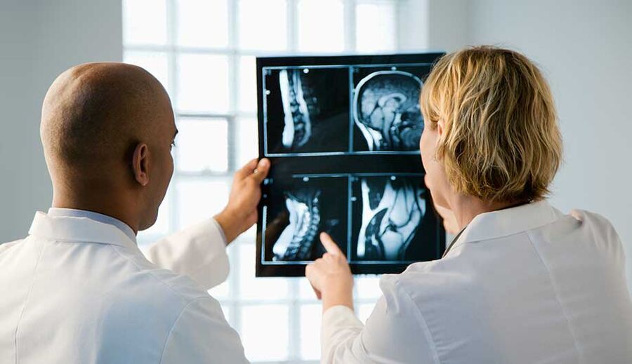 diagnosi di osteocondrosi cervicale per immagini