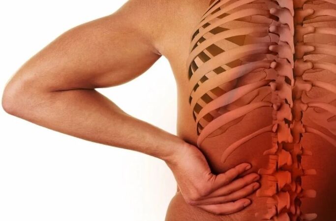 Osteocondrosi lombare