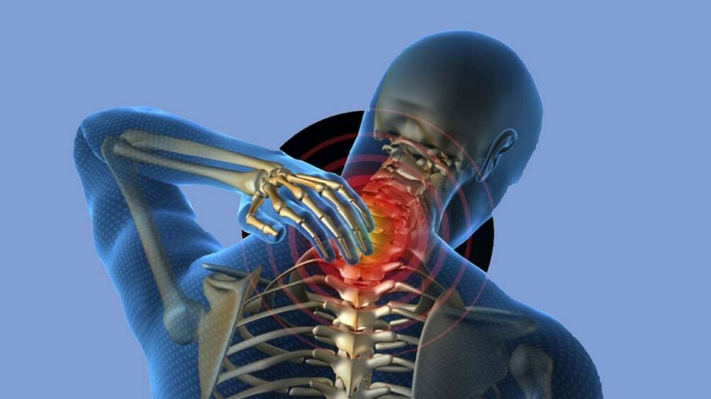 Osteocondrosi della regione cervicale