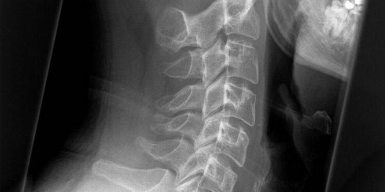 Un'immagine della regione cervicale