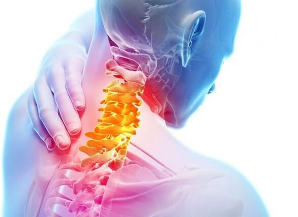 Osteocondrosi della colonna cervicale