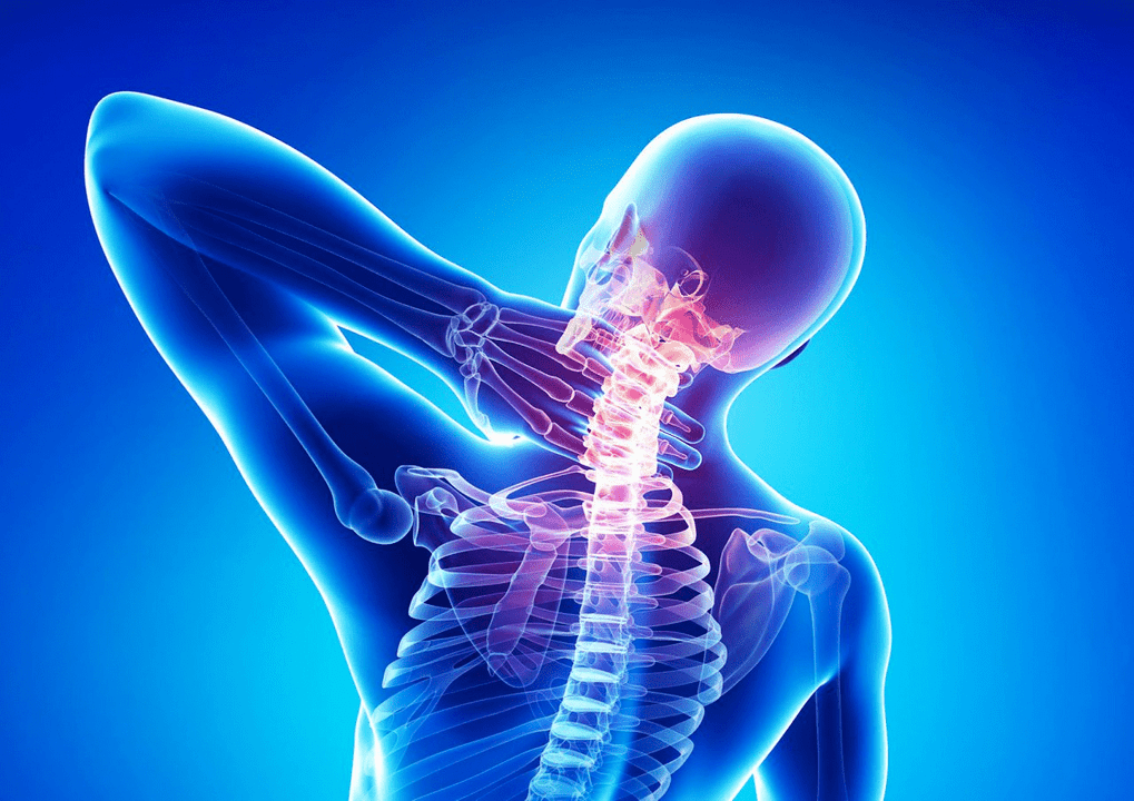 Osteocondrosi della colonna vertebrale