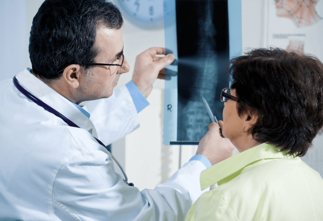 Un neurologo diagnostica l'osteocondrosi utilizzando la radiografia della colonna vertebrale