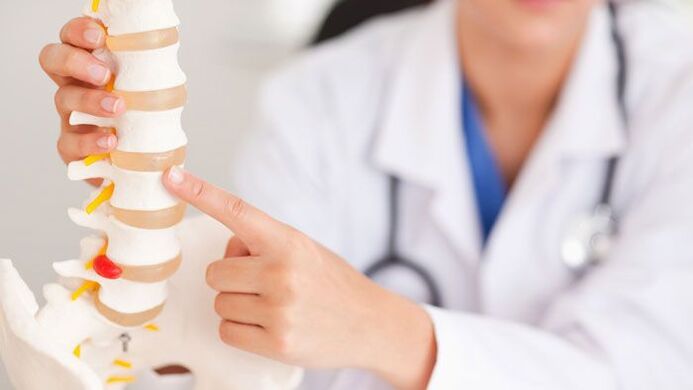 spiegazione dell'osteocondrosi lombare su un modello della colonna vertebrale